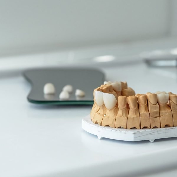 smile rep dental lab img 5 smile rep dental lab img 5